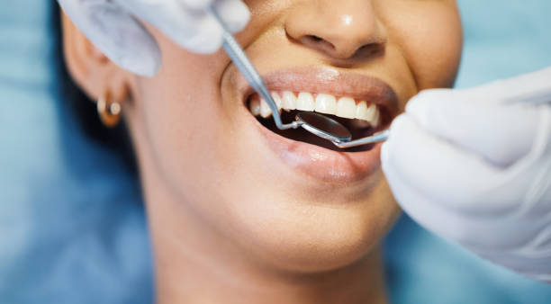 Best Emergency Tooth Extraction in Five Points, OH